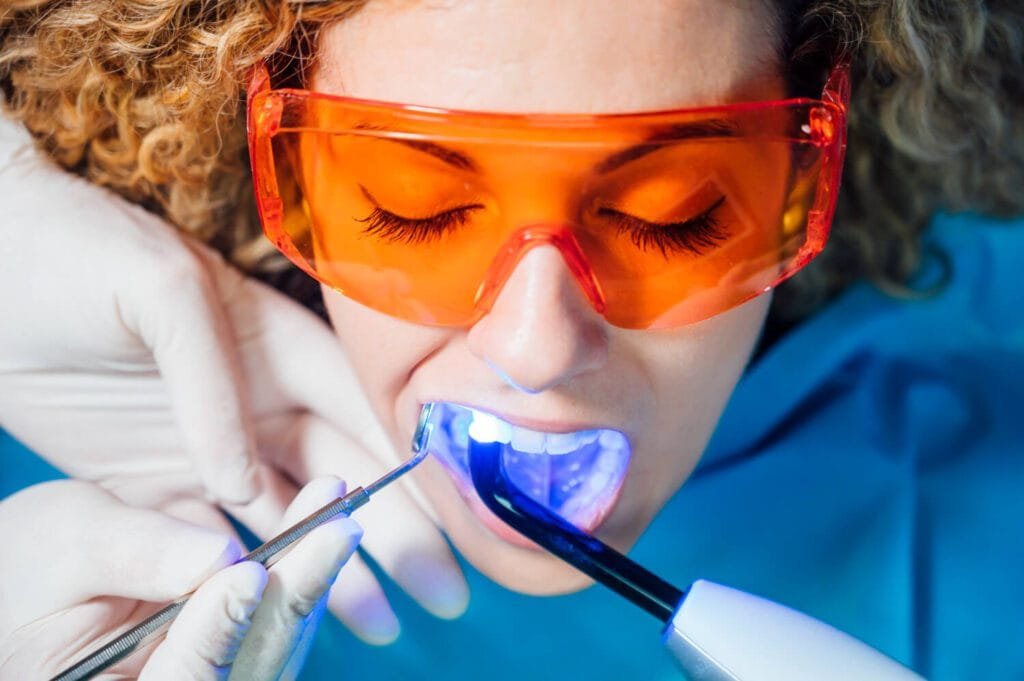 Clareamento Dental Jovem