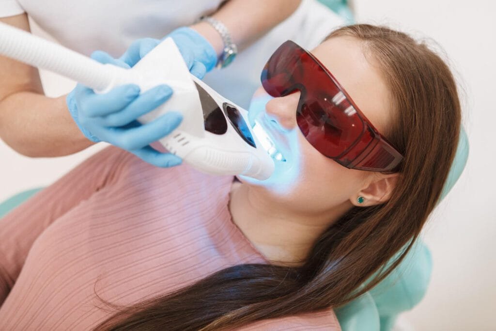 Clareamento Dental Jovem laserterapia odontológica